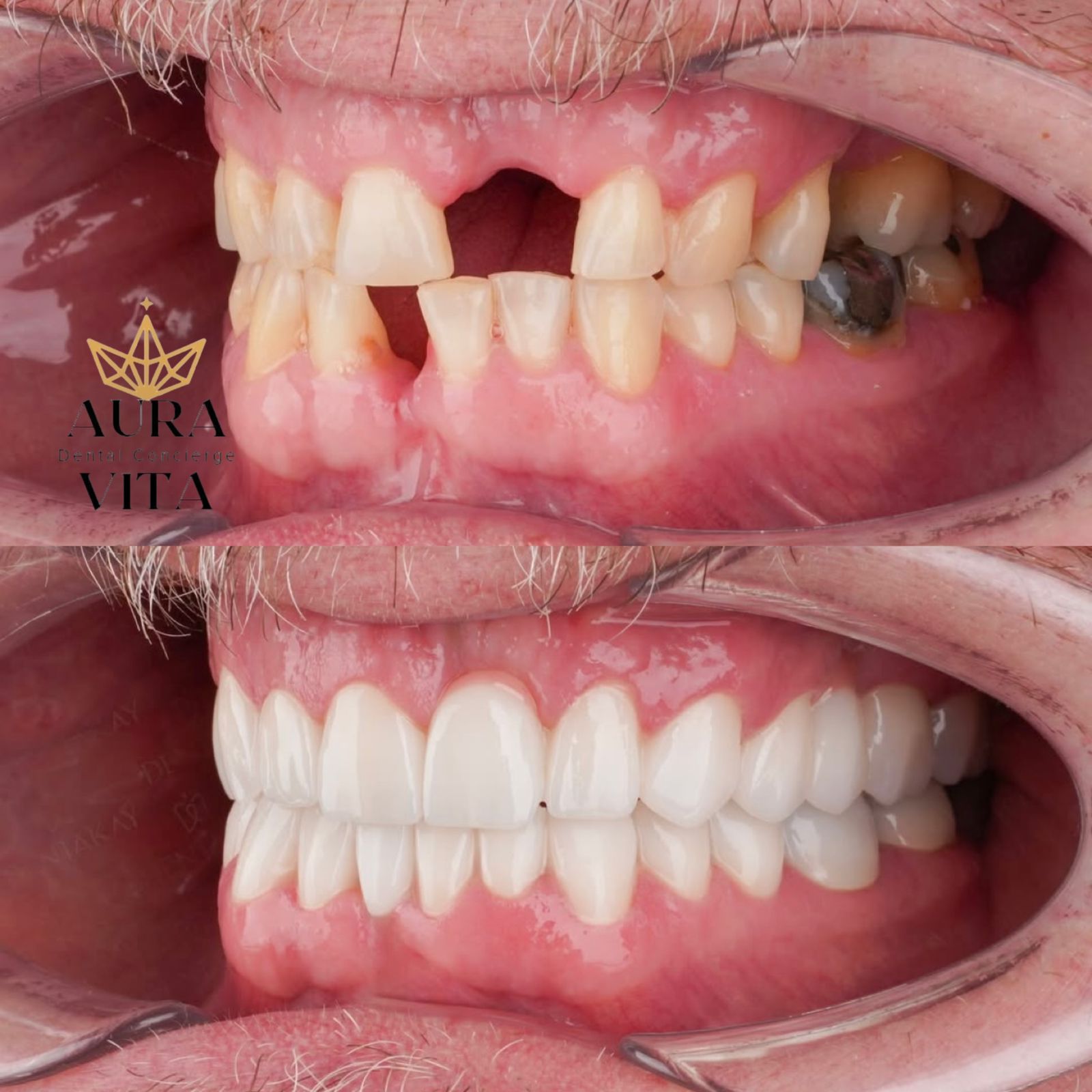 Before & After Transformation 1