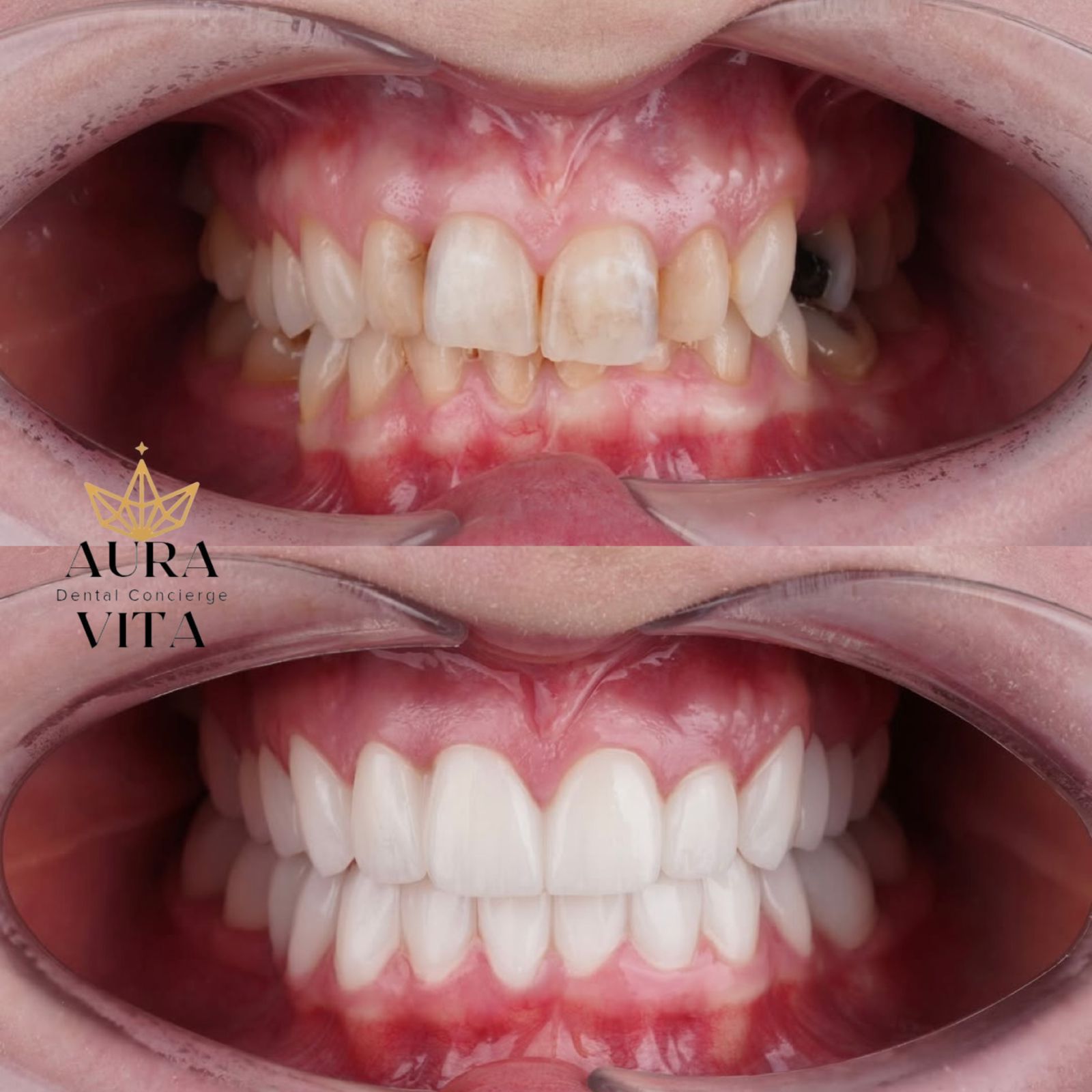 Before & After Transformation 2