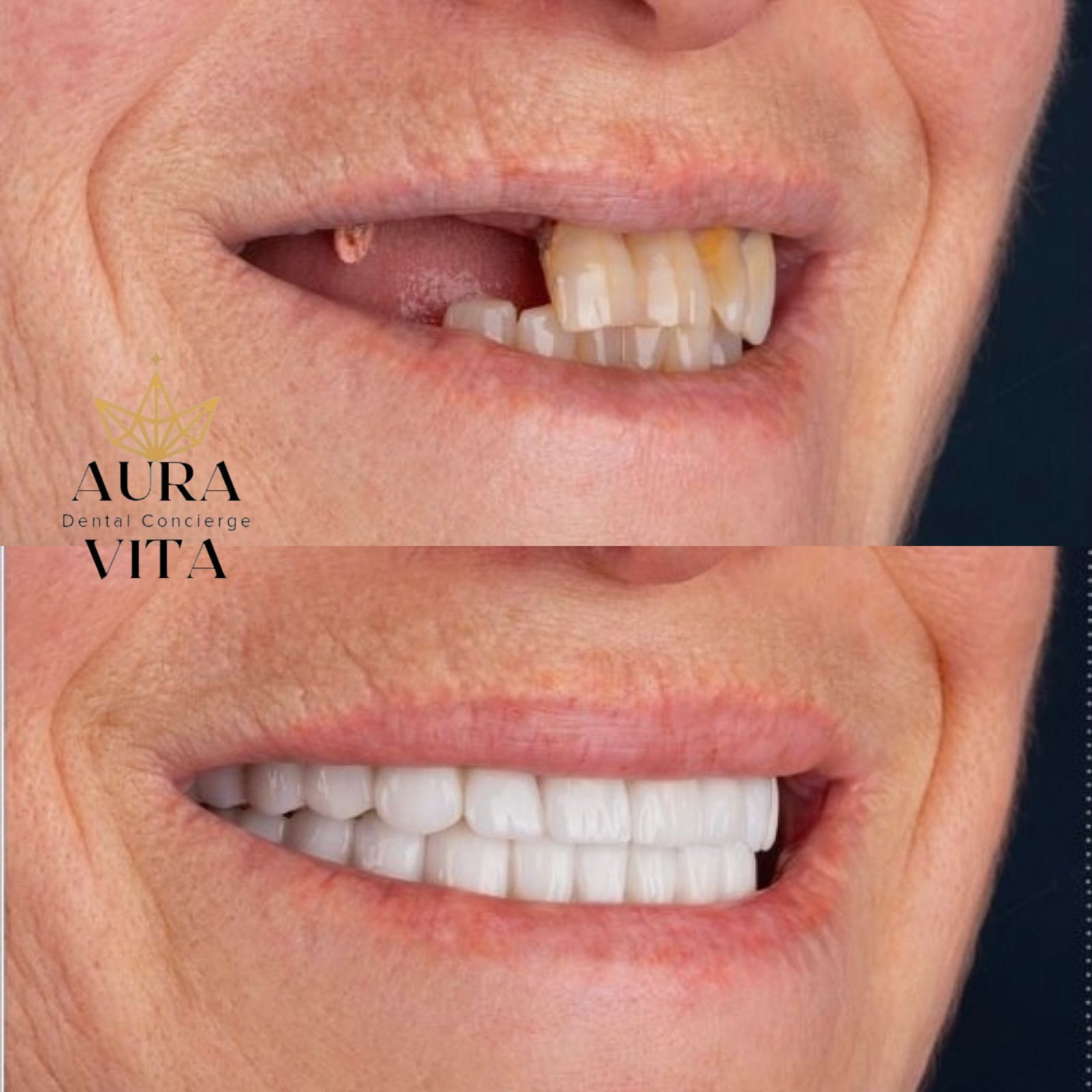 Before & After Transformation 3