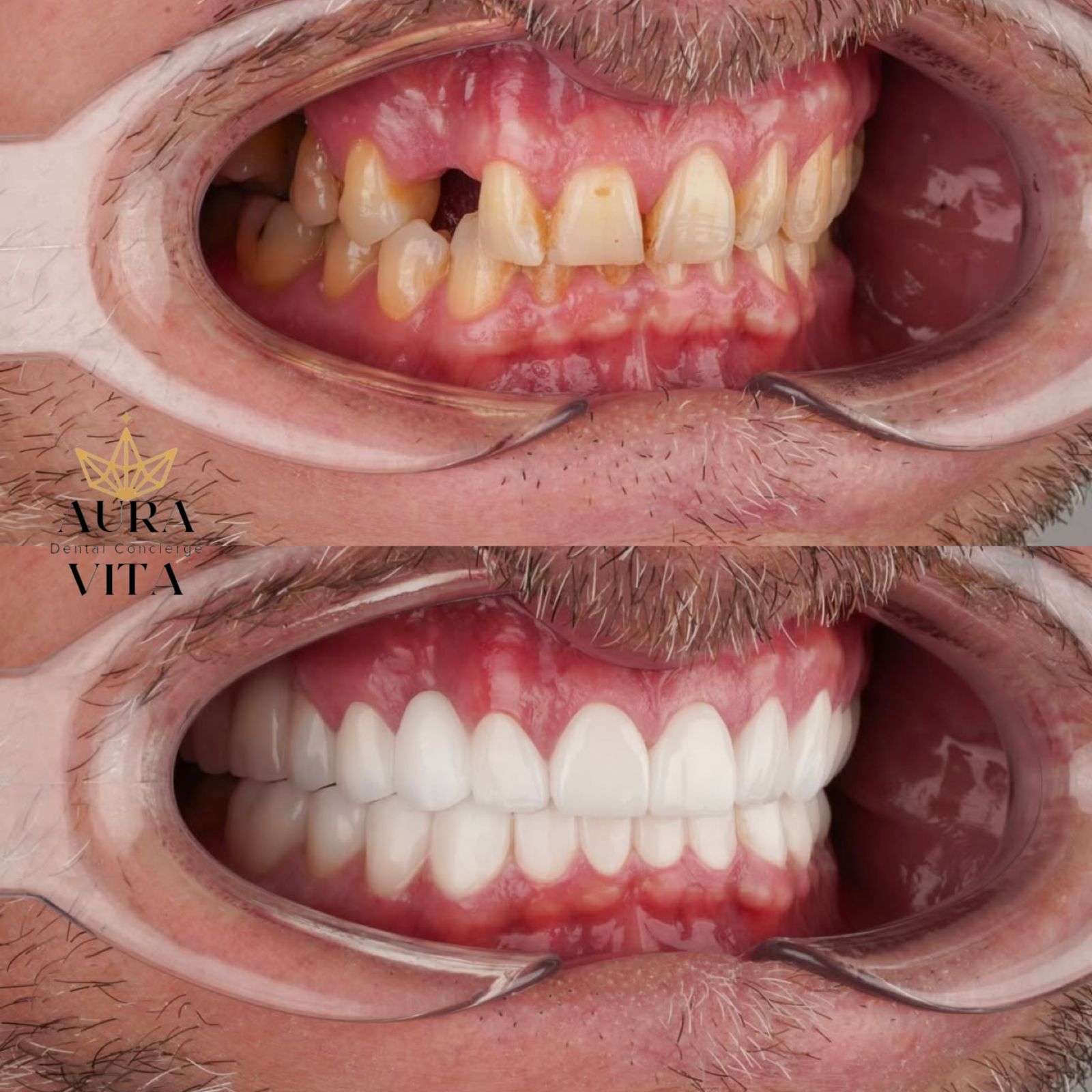 Before & After Transformation 4
