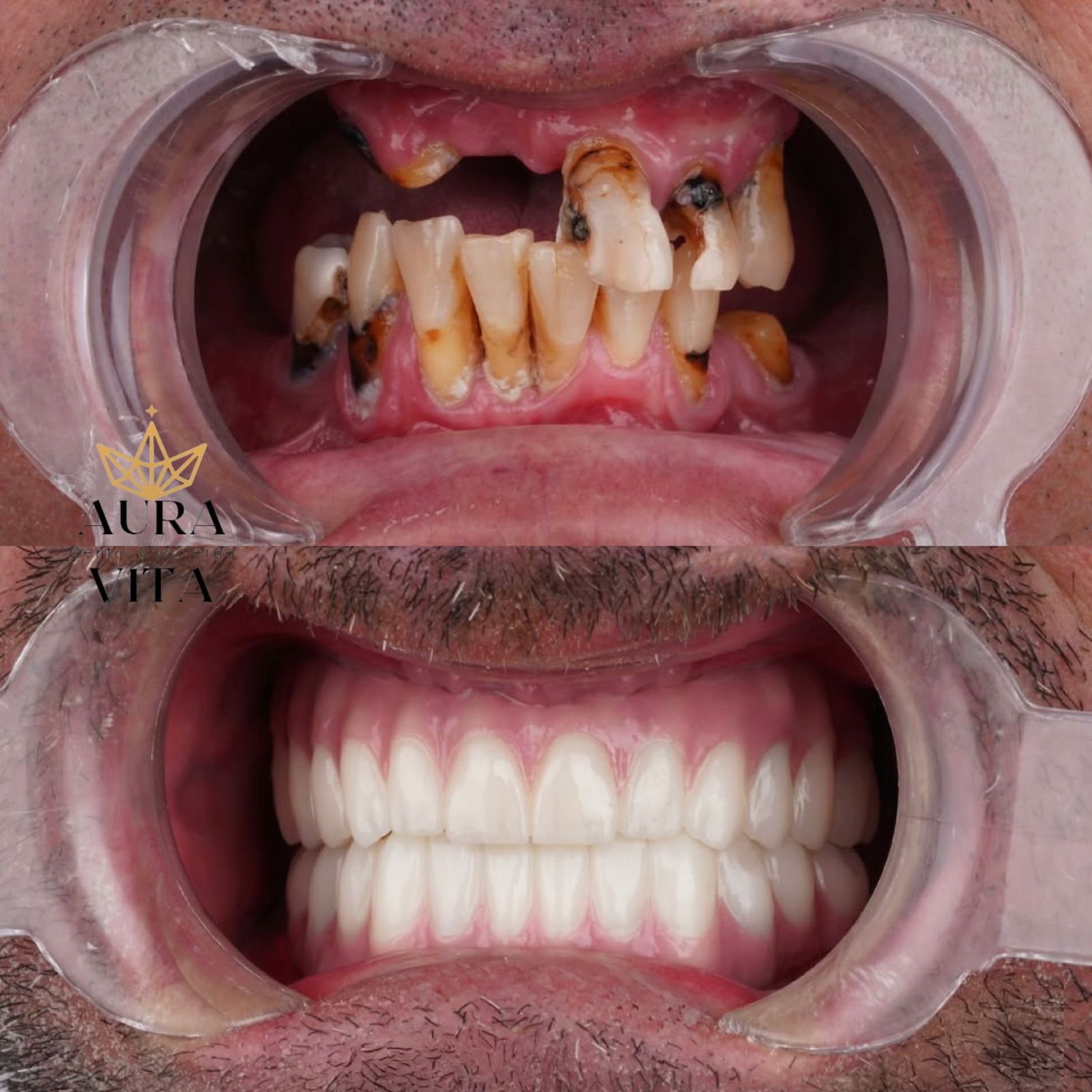 Before & After Transformation 5