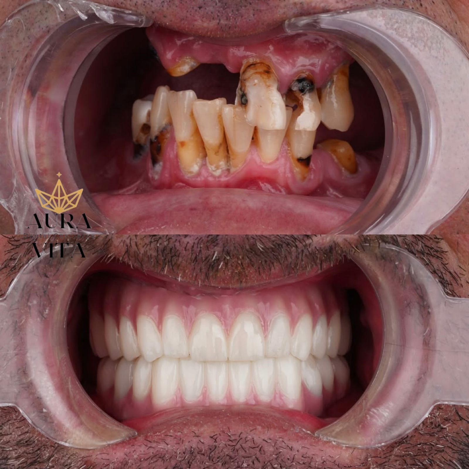 Before & After Transformation 7