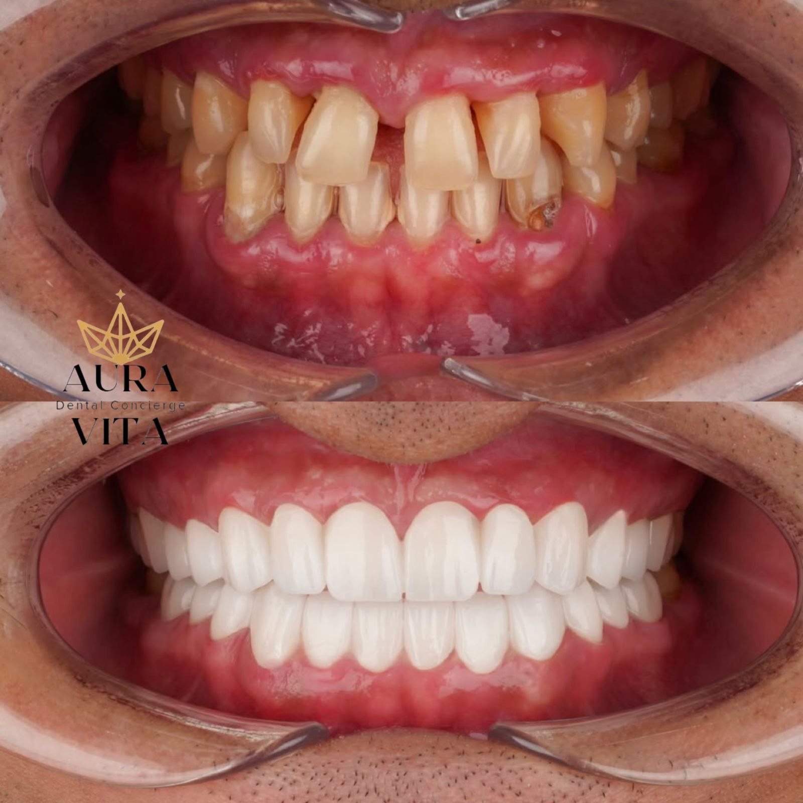 Before & After Transformation 8